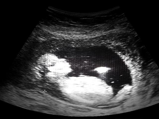 baby-ultrasound-picture_si.jpg