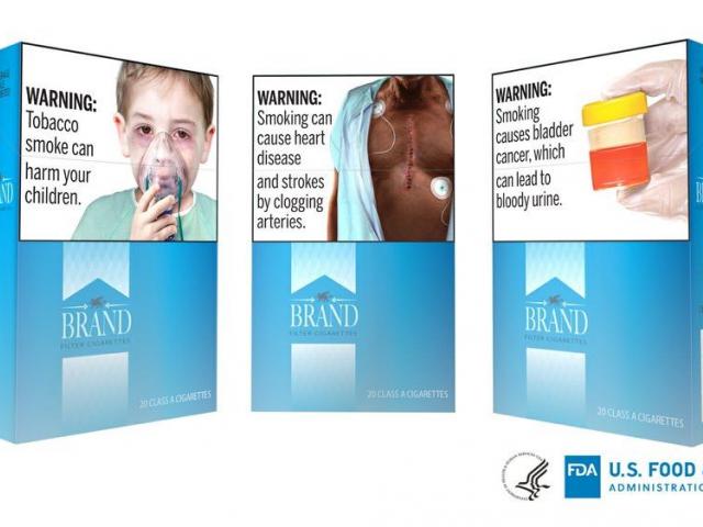 This undated image provided by the U.S. Food and Drug Administration shows proposed graphic warnings that would appear on cigarettes. (FDA via AP)