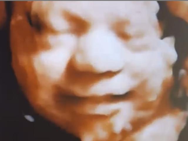 3D ultrasound reveals unborn baby smiling in the womb (Image: courtesy PregnantSee)