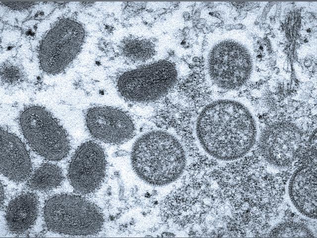 An 2003 electron microscope image made available by the Centers for Disease Control and Prevention shows mature, oval-shaped monkeypox virions, left, and spherical immature virions, right (Cynthia S. Goldsmith, Russell Regner/CDC via AP, file)
