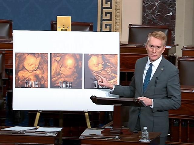 Sen. James Lankford shows the Senate what an unborn baby looks like in a 3D ultrasound (Image: Screen capture)
