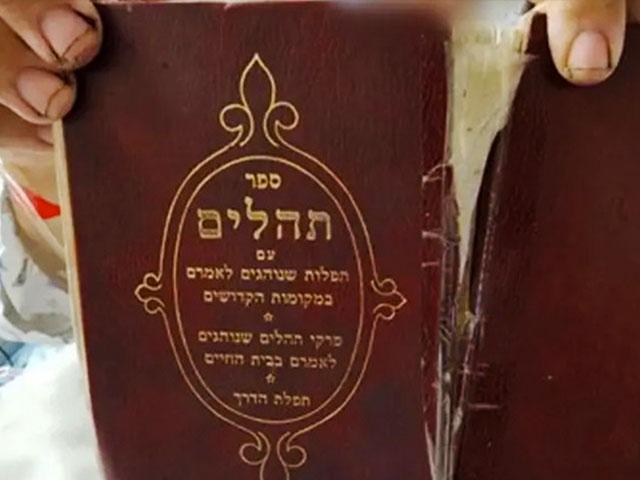 The Book of Psalms, held by the bombing victim, prevented a shard of debris from piercing his body. (Photo: Shaare Zedek Medical Center)