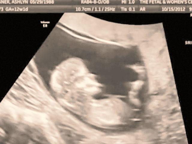 Ultrasound, Baby