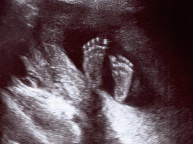 Ultrasound of unborn baby feet