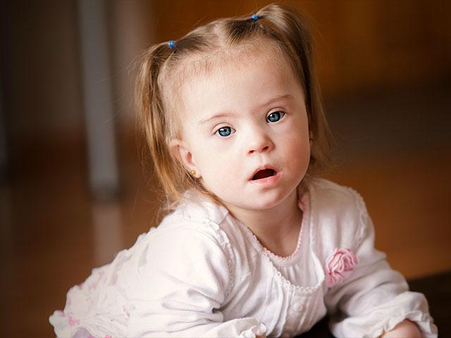 These Adorable Pictures of Kids with Down Syndrome Prove Iceland’s Push ...