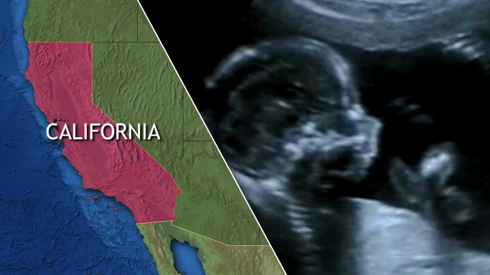 California is working on a plan to become a &quot;sanctuary&quot; state for abortion.