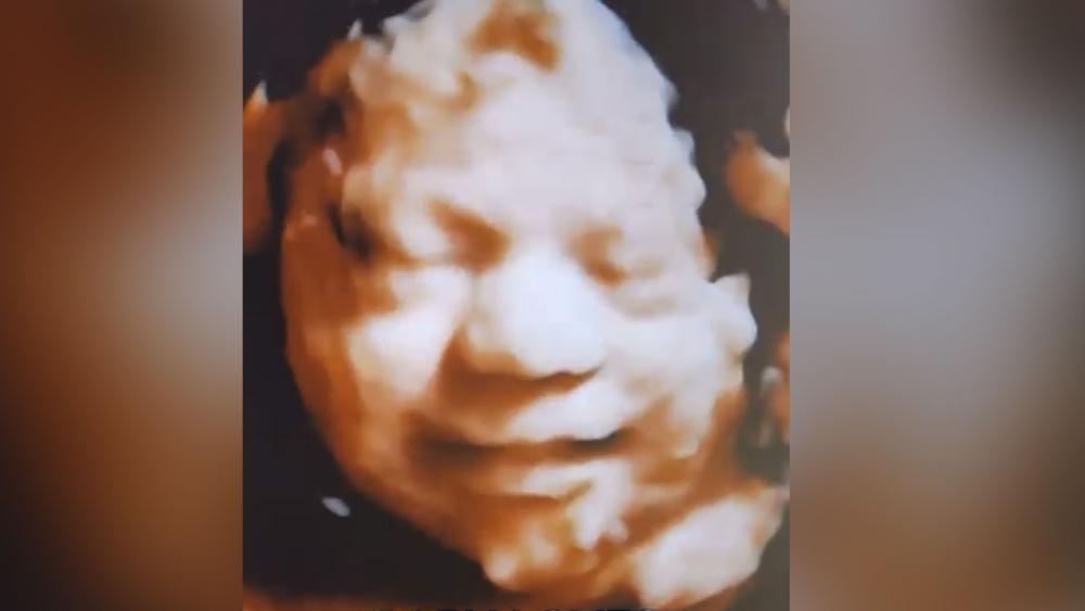 Unborn baby smiling in the womb (Image: 3D Ultrasound from PregnantSee) 