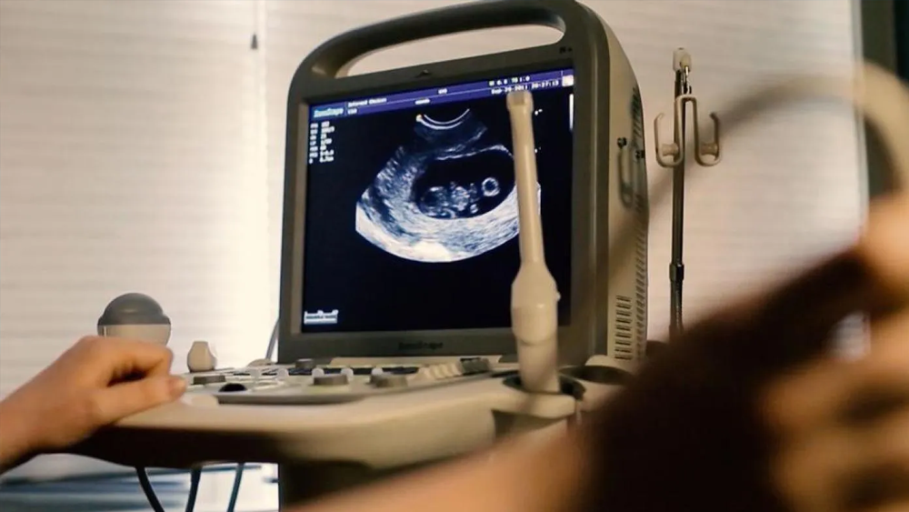 imagen_cbn_ultrasonido_en_consultorio.png