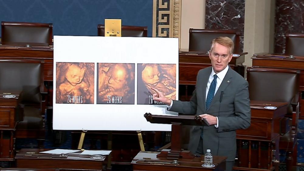 Sen. James Lankford shows the Senate what an unborn baby looks like in a 3D ultrasound (Image: Screen capture)